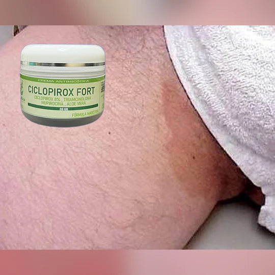 Ciclopirox Fort 8% - Elimina tiñas inguinal e infecciones por hongos